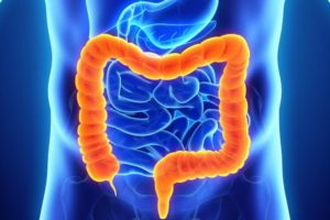 NACIONALNI PROGRAM RANOG OTKRIVANJA RAKA DEBELOG CRIJEVA Slika